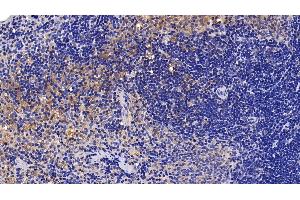 Immunohistochemistry (IHC) image for anti-Interleukin 1 Receptor Accessory Protein (IL1RAP) (AA 420-558) antibody (ABIN7438568)