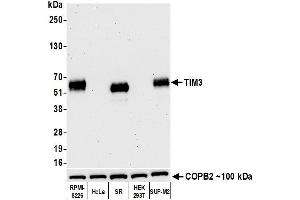 Western Blotting (WB) image for anti-Hepatitis A Virus Cellular Receptor 2 (TIM 3) (AA 22-201) antibody (ABIN7449550)