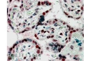 ABIN185492 (2. (CBX1 抗体  (Internal Region))