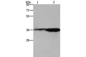 Western Blot analysis of 293T cell and Mouse brain tissue using CD89 Polyclonal Antibody at dilution of 1:550 (FCAR 抗体)
