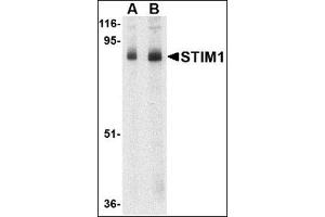 Western blot analysis of STIM1 in mouse thymus tissue lysate with this product at (A) 1 and (B) 2 μg/ml. (STIM1 抗体  (C-Term))
