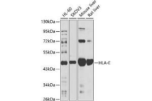 Western Blotting (WB) image for anti-HLA Class I Histocompatibility Antigen, alpha Chain E (HLA-E) (AA 22-200) antibody (ABIN6141842)