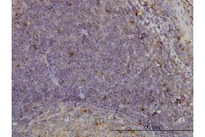 Immunoperoxidase of monoclonal antibody to MCF2L on formalin-fixed paraffin-embedded human tonsil. (MCF2L 抗体  (AA 220-319))