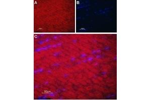 Immunohistochemistry (IHC) image for anti-ATPase, Ca++ Transporting, Cardiac Muscle, Fast Twitch 1 (ATP2A1) (AA 25-37), (Cytosolic) antibody (ABIN7042953)
