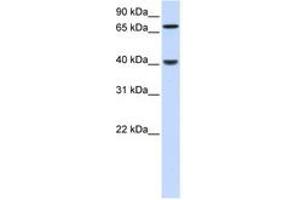 PDLIM3 抗体  (N-Term)