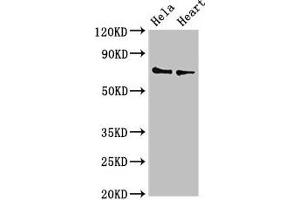 Western Blot Positive WB detected in: Hela whole cell lysate, Mouse heart tissue All lanes: PLS3 antibody at 3. (Plastin 3 抗体  (AA 310-455))