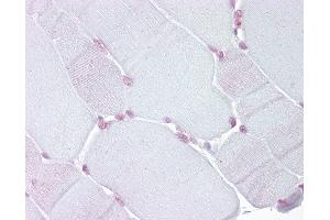 Anti-TEF antibody IHC of human skeletal muscle. (TEF 抗体  (N-Term))