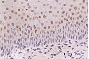 Immunohistochemistry (IHC) image for anti-Cyclin-Dependent Kinase Inhibitor 1A (p21, Cip1) (CDKN1A) antibody (ABIN487485) (p21 抗体)