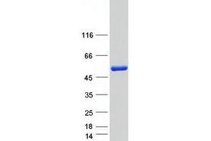 Western Blotting (WB) image for Nuclear Prelamin A Recognition Factor (NARF) (Transcript Variant 1) protein (Myc-DYKDDDDK Tag) (ABIN2726831)