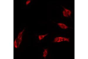 ABIN6274974 staining Hela by IF/ICC. (CEACAM21 抗体  (C-Term))