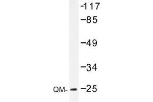Image no. 1 for anti-Ribosomal Protein L10 (RPL10) antibody (ABIN317605) (RPL10 抗体)
