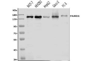 Western blot analysis of PAR-3/PARD3 using anti-PAR-3/PARD3 antibody (ABIN7598983).