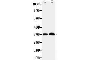 Anti-Aquaporin 5 antibody, Western blotting Lane 1: Rat Lung Tissue Lysate Lane 2: Rat Testis Tissue Lysate (Aquaporin 5 抗体  (C-Term))