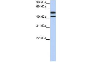 GNS antibody used at 1 ug/ml to detect target protein. (GNS 抗体  (C-Term))