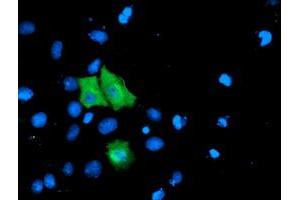 Anti-TOMM34 mouse monoclonal antibody (ABIN2454766) immunofluorescent staining of COS7 cells transiently transfected by pCMV6-ENTRY TOMM34 (RC201083). (TOMM34 抗体)