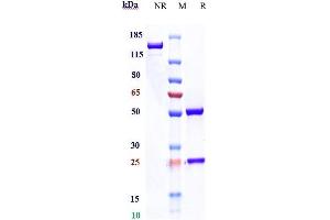 Anti- Human CD47(Magrolimab) on SDS-PAGE under reducing (R) condition.
