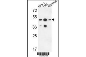 Western blot analysis in MCF-7,CEM,NCI-H460 cell line lysates (35ug/lane). (Sphingomyelin Synthase 2 抗体  (C-Term))
