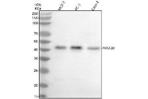 Western blot analysis of NAT12/NAA30 using anti-NAT12/NAA30 antibody (ABIN7602299).