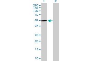Western Blot analysis of MASP1 expression in transfected 293T cell line by MASP1 MaxPab polyclonal antibody. (MASP1 抗体  (AA 1-380))