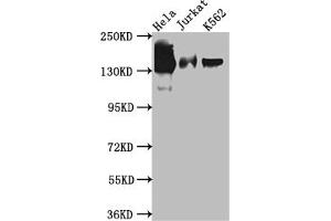 Western Blot Positive WB detected in: Hela whole cell lysate, Jurkat whole cell lysate, K562 whole cell lysate All lanes: SA2 antibody at 1:1000 Secondary Goat polyclonal to rabbit IgG at 1/50000 dilution Predicted band size: 142, 146 kDa Observed band size: 142 kDa (Recombinant STAG2 抗体)