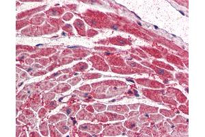 Anti-PIK3CA antibody IHC of human heart. (PIK3CA 抗体  (AA 878-891))