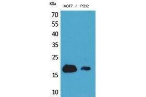 Western Blotting (WB) image for anti-Interferon-Induced Transmembrane Protein 1 (IFITM1) (N-Term) antibody (ABIN3178494) (IFITM1 抗体  (N-Term))