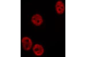 ABIN6275194 staining  COLO205 cells by IF/ICC. (Msx2/Hox8 抗体  (Internal Region))