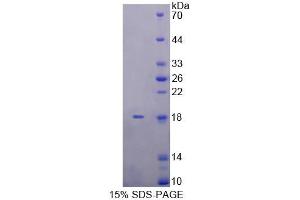 SDS-PAGE analysis of Rat KLRK1 Protein. (KLRK1 蛋白)