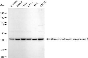Western blotting analysis using Glutamic-oxaloacetic transaminase 2 antibody (ABIN7798746). (Recombinant GOT2 抗体)