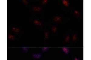 Immunofluorescence analysis of U-2 OS cells using SF3B1 Polyclonal Antibody at dilution of 1:100. (SF3B1 抗体)