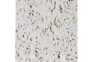 Immunohistochemistry (Paraffin-embedded Sections) (IHC (p)) image for anti-Nuclear Autoantigenic Sperm Protein (Histone-Binding) (NASP) (AA 180-449) antibody (ABIN6144374)
