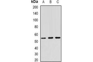 Western blot analysis of RNF81 expression in A549 (A), SW620 (B), HT29 (C) whole cell lysates. (TRIM21 抗体)