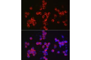 Immunofluorescence (IF) image for anti-Calcium/calmodulin-Dependent Protein Kinase IV (CAMK4) (AA 304-473) antibody (ABIN6137891)
