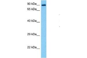 Western Blotting (WB) image for anti-Signal Transducer and Activator of Transcription 1, 91kDa (STAT1) (N-Term) antibody (ABIN2780843)