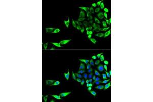 Immunofluorescence analysis of U2OS cells using GOT1 antibody (ABIN6131239, ABIN6141283, ABIN6141284 and ABIN6221514). (GOT1 抗体  (AA 244-413))