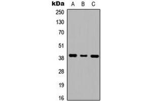 Western blot analysis of GALR1 expression in HEK293T (A), NS-1 (B), H9C2 (C) whole cell lysates. (Galanin Receptor 1 抗体  (Center))