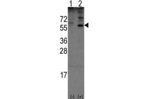 Western Blotting (WB) image for anti-Olfactomedin 1 (OLFM1) antibody (ABIN3001576) (Olfactomedin 1 抗体)