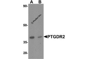 Western Blotting (WB) image for anti-Prostaglandin D2 Receptor 2 (PTGDR2) antibody (ABIN1077429) (Prostaglandin D2 Receptor 2 (PTGDR2) 抗体)