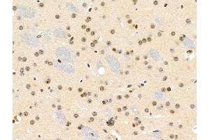 Phospho-MKK3/MKK6 (Ser189/Ser207) Antibody at 1/100 staining Mouse brain tissue by IHC-P.