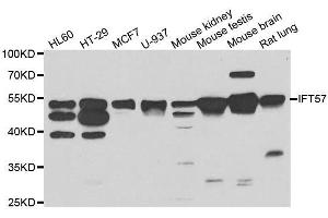 Western blot analysis of extracts of various cell lines, using IFT57 antibody. (IFT57 抗体  (AA 170-429))