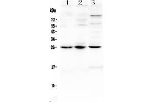 Western blot analysis of TREM1 using anti-TREM1 antibody .