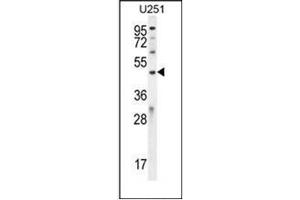 Western blot analysis of IPCEF1 / PIP3-E Antibody (C-term) in U251 cell line lysates (35ug/lane). (ICEF1 抗体  (C-Term))
