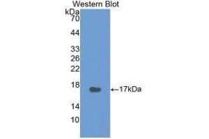 Detection of Recombinant CT, Human using Monoclonal Antibody to Calcitonin (CT) (Calcitonin 抗体  (AA 85-116))