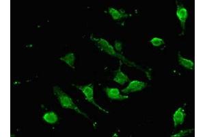Immunofluorescent analysis of U251 cells using ABIN7172642 at dilution of 1:100 and Alexa Fluor 488-congugated AffiniPure Goat Anti-Rabbit IgG(H+L) (SOX9 抗体  (AA 296-501))