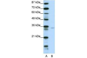 Western Blot showing ZNF177 antibody used at a concentration of 1-2 ug/ml to detect its target protein. (ZNF177 抗体  (N-Term))