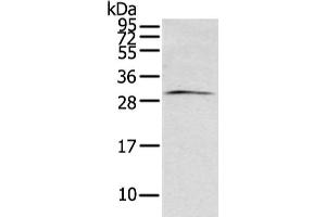 Gel: 12 % SDS-PAGE, Lysate: 40 μg, Lane: Mouse brain tissue, Primary antibody: ABIN7193096(ZFAND2B Antibody) at dilution 1/200 dilution, Secondary antibody: Goat anti rabbit IgG at 1/8000 dilution, Exposure time: 1 minute (ZFAND2B 抗体)