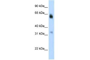 WB Suggested Anti-JMJD2D Antibody Titration:  0. (JMJD2D 抗体  (C-Term))