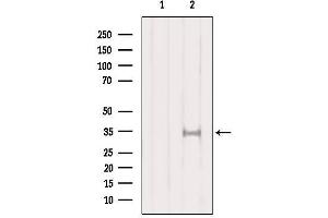 Western blot analysis of extracts from HepG2, using SULT1A1  Antibody. (SULT1A1 抗体  (Internal Region))