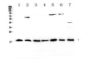 Western blot analysis of IL23 using anti-IL23 antibody . (IL23A 抗体  (AA 20-178))