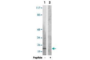 Western blot analysis of extracts from HepG2 cells, using SDC4 polyclonal antibody . (SDC4 抗体  (Ser179))